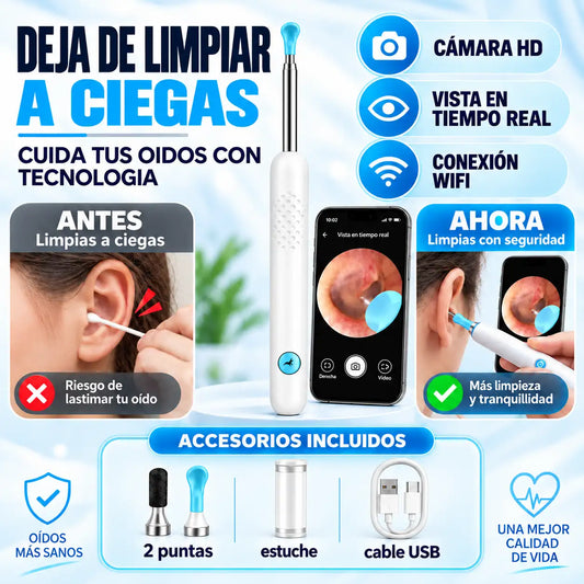 Limpiador de Oídos con Cámara HD | Deja de limpiar a ciegas 👂📱